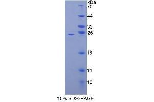 SDS-PAGE (SDS) image for Nuclear Factor kappa B2 (AA 25-224) protein (His tag) (ABIN1080400) (Nuclear Factor kappa B2 (AA 25-224) protein (His tag))