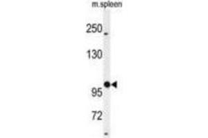 Western Blotting (WB) image for anti-UDP-N-Acetyl-alpha-D-Galactosamine:polypeptide N-Acetylgalactosaminyltransferase 5 (GalNAc-T5) (GALNT5) antibody (ABIN3004405) (GALNT5 antibody)