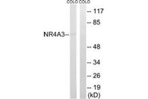 Western blot analysis of extracts from COLO cells, using NR4A3 Antibody.