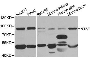 Western blot analysis of extracts of various cell lines, using NT5E antibody. (CD73 antibody)