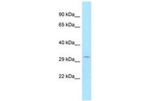 Image no. 1 for anti-Centromere Protein V (CENPV) (C-Term) antibody (ABIN6747960) (CENPV antibody  (C-Term))