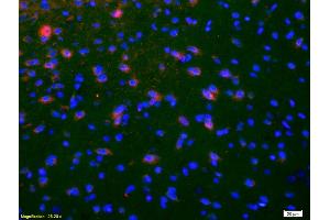 Formalin-fixed and paraffin-embedded rat brain labeled with Anti-NKB Polyclonal Antibody, Unconjugated (ABIN724460) 1:200, overnight at 4°C, The secondary antibody was Goat Anti-Rabbit IgG,Cy3 conjugated used at 1:200 dilution for 40 minutes at 37°C. (Tachykinin 3 antibody  (AA 81-90))