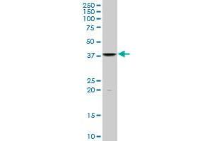 FUSIP1 monoclonal antibody (M07), clone 1G11. (SRSF10 antibody  (AA 1-100))