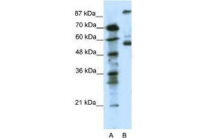 WB Suggested Anti-HTR7 Antibody Titration: 0. (HTR7 antibody  (N-Term))