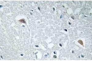 Immunohistochemistry analysis of Synapsin-1 Antibody in paraffin-embedded human brain tissue. (SYN1 antibody)