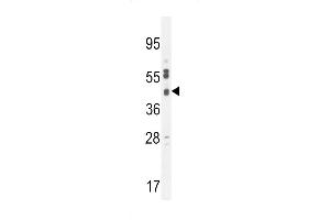 C Antibody (C-term) (ABIN654459 and ABIN2844192) western blot analysis in  cell line lysates (35 μg/lane). (SLC35F6 antibody  (C-Term))