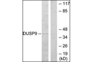 Western blot analysis of extracts from HeLa cells, using DUSP9 Antibody . (DUSP9 antibody  (Internal Region))