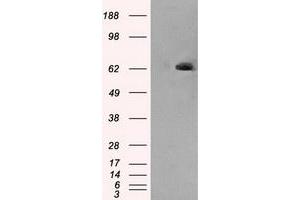 HEK293T cells were transfected with the pCMV6-ENTRY control (Left lane) or pCMV6-ENTRY LTA4H (Right lane) cDNA for 48 hrs and lysed. (LTA4H antibody)