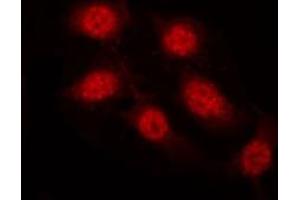 Immunofluorescence (fixed cells) (IF/ICC) image for anti-GATA Binding Protein 4 (GATA4) (pSer262) antibody (ABIN6256227)