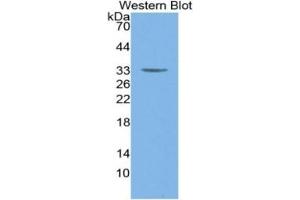 WB of Protein Standard: different control antibodies against Highly purified E. (MYH6 ELISA Kit)