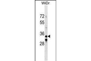 Western blot analysis in WiDr cell line lysates (35ug/lane). (ITGB1BP2 antibody  (C-Term))