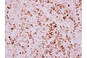 Image no. 1 for anti-Transmembrane Protease, serine 11D (TMPRSS11D) (AA 152-388) antibody (ABIN1501444) (TMPRSS11D antibody  (AA 152-388))
