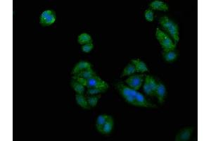 Immunofluorescence staining of HepG2 cells with ABIN7163230 at 1:200, counter-stained with DAPI. (PICALM antibody  (AA 517-624))