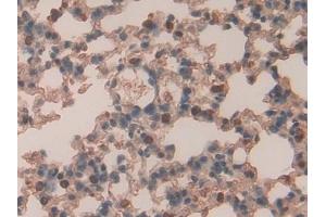 Detection of RARa in Mouse Lung Tissue using Polyclonal Antibody to Retinoic Acid Receptor Alpha (RARa) (Retinoic Acid Receptor alpha antibody  (AA 237-459))