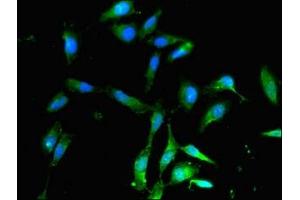 Immunofluorescent analysis of Hela cells using ABIN7142472 at dilution of 1:100 and Alexa Fluor 488-congugated AffiniPure Goat Anti-Rabbit IgG(H+L) (ALDH9A1 antibody  (AA 12-144))