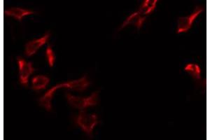 ABIN6274717 staining Hela by IF/ICC. (MRPS12 antibody  (Internal Region))