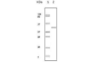 Western blot analysis using ABL2 mouse mAb against truncated ABL2 recombinant protein. (ABL2 antibody)