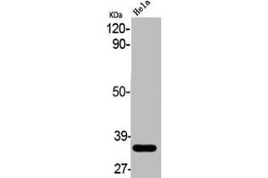Western Blot analysis of HELA cells using ABCC13 Polyclonal Antibody (ABCC13 antibody  (Internal Region))