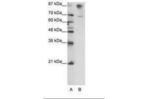 Image no. 3 for anti-HKR1, GLI-Kruppel Zinc Finger Family Member (HKR1) (C-Term) antibody (ABIN6736165) (HKR1 antibody  (C-Term))
