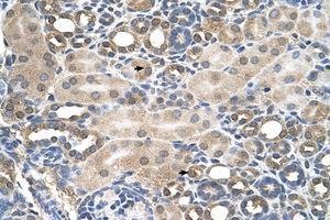 Image no. 1 for anti-Hemochromatosis (HFE) (AA 149-198) antibody (ABIN6736669) (HFE antibody  (AA 149-198))