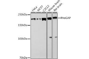 Western blot analysis of extracts of various cell lines, using RhoGAP Rabbit mAb (ABIN1682830, ABIN3016006, ABIN3016007 and ABIN7101474) at 1:1000 dilution.