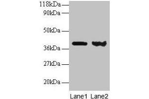 Western blot All lanes: ARHGDIA antibody at 2 μg/mL Lane 1: EC109 whole cell lysate Lane 2: 293T whole cell lysate Secondary Goat polyclonal to rabbit IgG at 1/15000 dilution Predicted band size: 24, 19 kDa Observed band size: 40 kDa (ARHGDIA antibody  (AA 2-204))