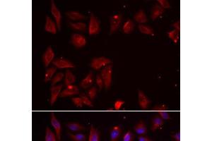 Immunofluorescence analysis of U2OS cells using PDXK Polyclonal Antibody (PDXK antibody)