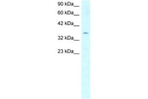 Western Blotting (WB) image for anti-Stearoyl-CoA Desaturase (Delta-9-Desaturase) (SCD) antibody (ABIN2460578) (SCD antibody)