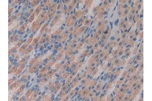Immunohistochemistry (IHC) image for anti-ArfGAP with Dual PH Domains 2 (ADAP2) (AA 49-360) antibody (ABIN7443242)