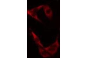ABIN6275710 staining 293 cells by IF/ICC. (TACC3 antibody  (C-Term))
