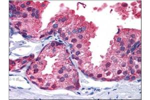 Immunohistochemistry Image: Human Prostate: Formalin-Fixed, Paraffin-Embedded (FFPE) (PDE4B antibody  (C-Term))