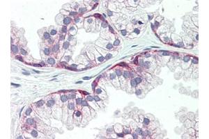 Immunohistochemistry (Paraffin-embedded Sections) (IHC (p)) image for anti-Syndecan 1 (SDC1) (AA 18-218) antibody (ABIN5611437)