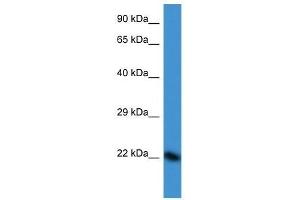 Western Blot showing DUX3 antibody used at a concentration of 1. (DUX3 antibody  (N-Term))