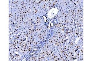IHC analysis of U1A/SNRPA using anti-U1A/SNRPA antibody (ABIN7600891). (SNRPA1 antibody  (AA 25-218))