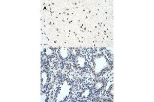Immunohistochemical staining (Formalin-fixed paraffin-embedded sections) of human brain (A) and lung (B) with BLZF1 polyclonal antibody  at 4-8 ug/mL working concentration. (BLZF1 antibody  (C-Term))