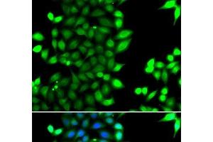 Immunofluorescence analysis of MCF-7 cells using RNF7 Polyclonal Antibody (RNF7 antibody)