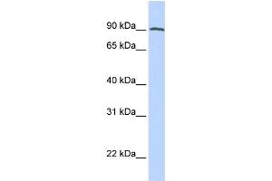 WB Suggested Anti-FOLH1 Antibody Titration:  0. (PSMA antibody  (C-Term))