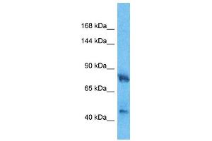 Host:  Rabbit  Target Name:  HMGCR  Sample Type:  Fetal Lung lysates  Antibody Dilution:  1. (HMGCR antibody  (C-Term))