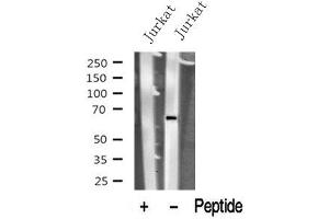 Western blot analysis of PNKP in lysates of Jurkat? (PNKP antibody  (Internal Region))