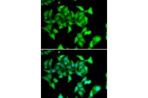 Immunofluorescence analysis of MCF7 cells using MYO1C antibody. (Myosin IC antibody  (AA 769-1028))