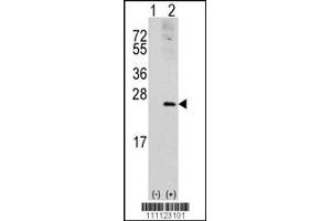 Western blot analysis of RAC1 using rabbit polyclonal RAC1 Antibody (S71). (RAC1 antibody  (AA 49-78))