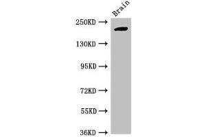 Western Blot Positive WB detected in: Mouse brain tissue All lanes: RBBP6 antibody at 2. (RBBP6 antibody  (AA 51-97))