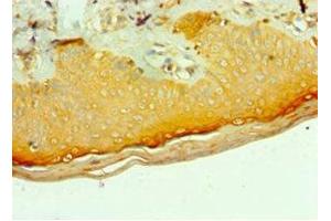 Immunohistochemistry of paraffin-embedded human skin tissue using ABIN7159246 at dilution of 1:100 (MLANA antibody  (AA 48-118))