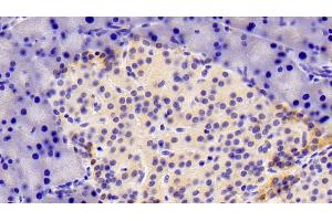 Detection of XRN1 in Rat Pancreas Tissue using Polyclonal Antibody to 5'-3'Exoribonuclease 1 (XRN1) (XRN1 antibody  (AA 1567-1723))