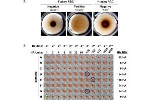 Hemagglutination (HA) assay (A) Samples lacking agglutinating activity (left panel) or containing IAV with agglutinating activity (center panel) were mixed with an equal volume of turkey RBCs (0.