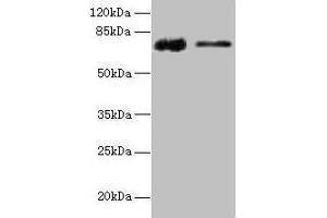 Western blot All lanes: GLCE antibody at 12 μg/mL Lane 1: Rat liver tissue Lane 2: Mouse kidney tissue Secondary Goat polyclonal to rabbit IgG at 1/10000 dilution Predicted band size: 71 kDa Observed band size: 71 kDa (GLCE antibody  (AA 29-617))