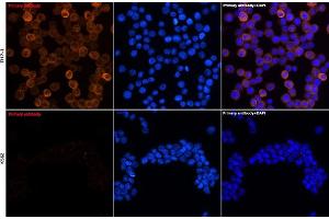 Immunofluorescence analysis of THP-1 and K562 cells using YKL-40/CHI3L1 Rabbit mAb (ABIN7266328) at dilution of 1:100 (40x lens). (CHI3L1 antibody)