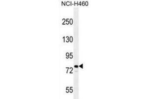 Western Blotting (WB) image for anti-helicase 2, X-linked (ATRX) antibody (ABIN2996469)
