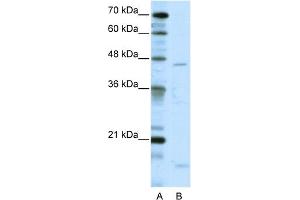 WB Suggested Anti-TRIAntibody Titration:  5. (TRIP13 antibody  (C-Term))