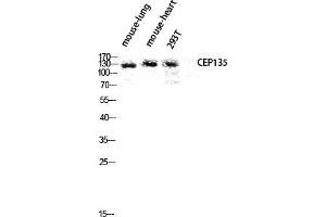 Western Blot (WB) analysis of Mouse Lung Mouse Heart 293T lysis using CEP135 antibody. (CEP135 antibody  (C-Term))